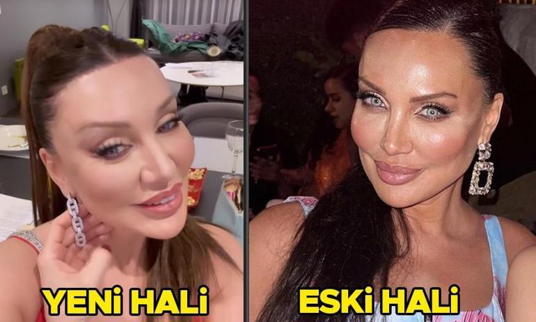 Dekolte bölgesine sünnet derisi enjekte ettirmişti... Seda Sayan yaşadığını değişimi anlattı