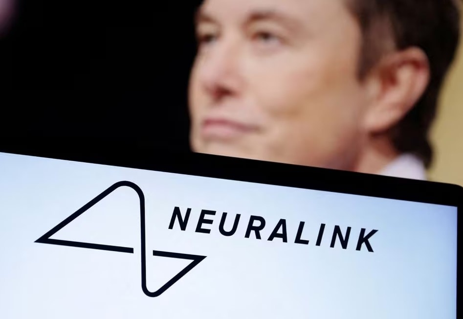 Musk'ın Şirketi İnsan Beynine Çip Yerleştirerek Yenilik Yaptı 1706604234 627 Muskin Sirketi Insan Beynine Cip Yerlestirerek Yenilik Yapti