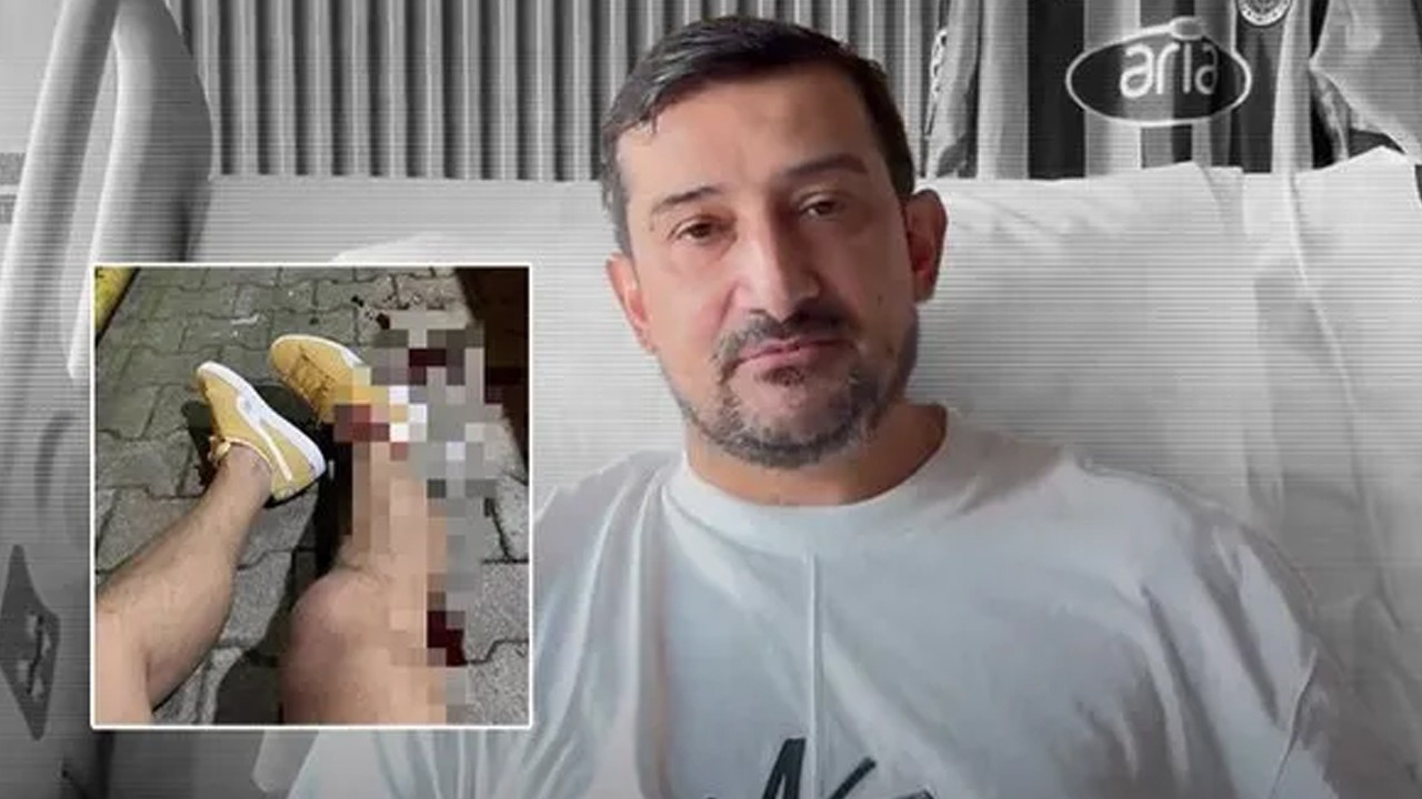 Silahli Saldiri Sonrasi Serhat Akindan Ilk Aciklama Bunlar Cok Asagilikca