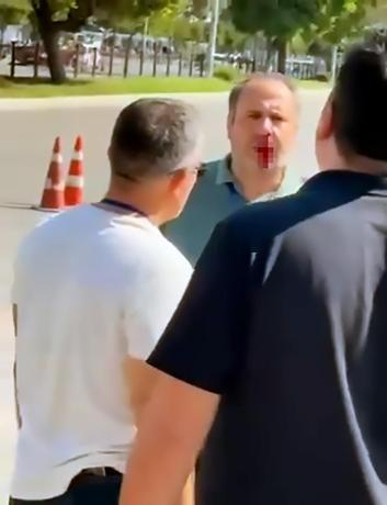Şüpheli, Eşinin Direksiyon Sınavını Geçemeyince Öğretmeni Darp Etti! Eşi direksiyon sınavını geçemeyince görevli öğretmenin burnunu kıran şüpheli tutuklandı