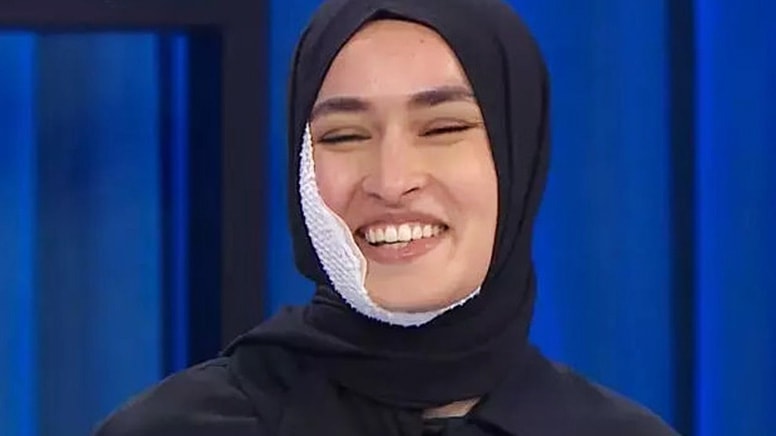 Beyza Huri Aydın Yüzündeki Yanıktan Tamamen İyileşti, İzleyicileri Şaşırttı MasterChef