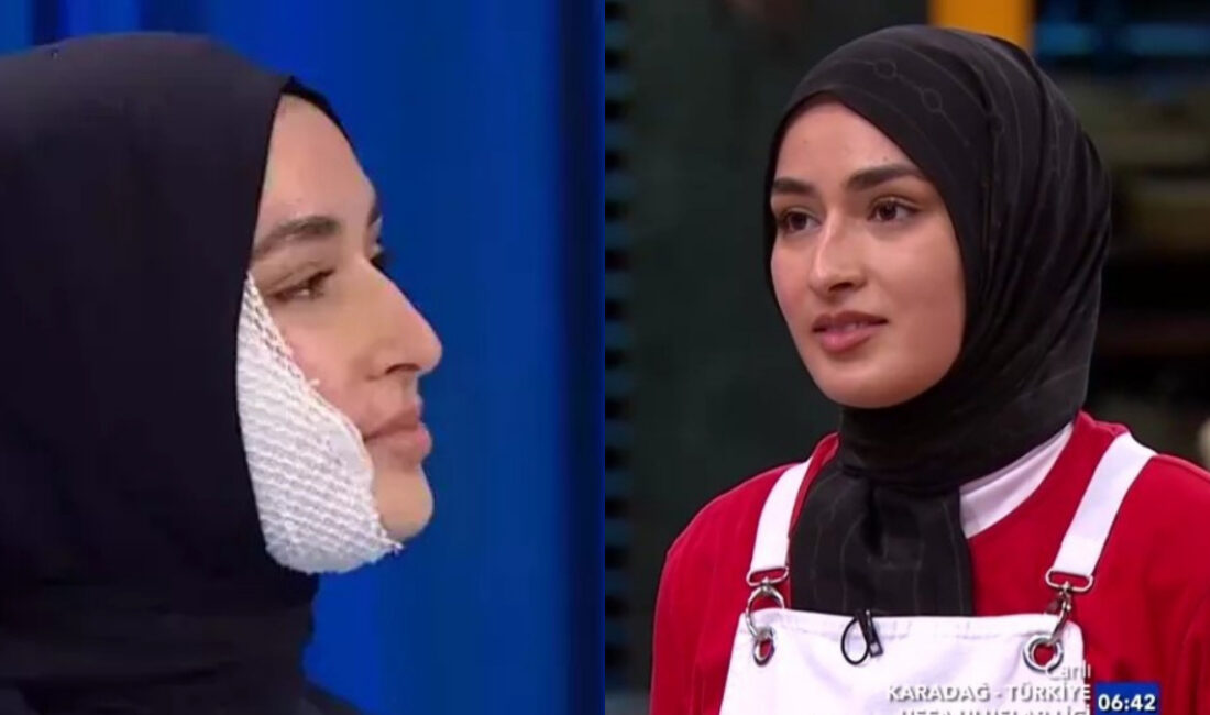 MasterChef Türkiye Yarışmacısı Beyza’nın Yüzündeki Kaza İzleri Şaşkınlık YarattıHaberin BaşlıklarıMasterChef