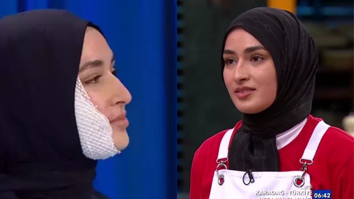 MasterChef Beyzanin Yuzunde Sifir Iz Gercek mi Kurgu mu