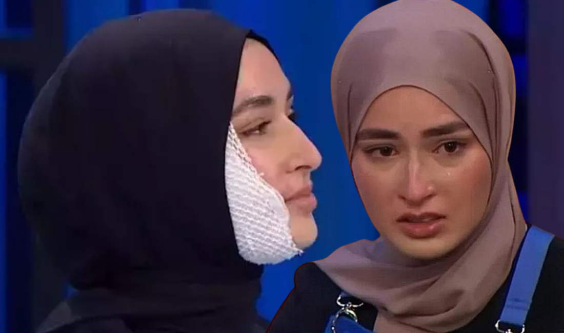 MasterChef Yarışmacısı Beyza, Yüzünü Yakma Kaza Sonrası Yarışmayı Sürdürecek TV8’in