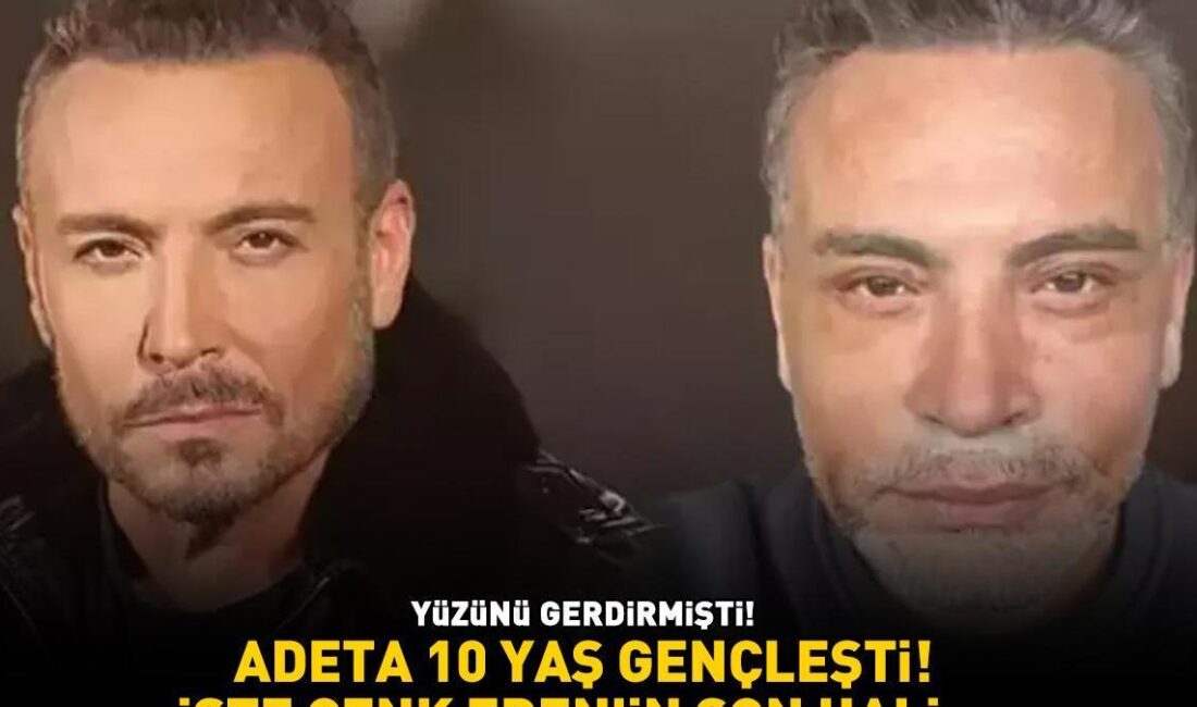 Cenk Eren Estetik Operasyon Geçirdi: Yüz Germe Ameliyatı Ünlü şarkıcı