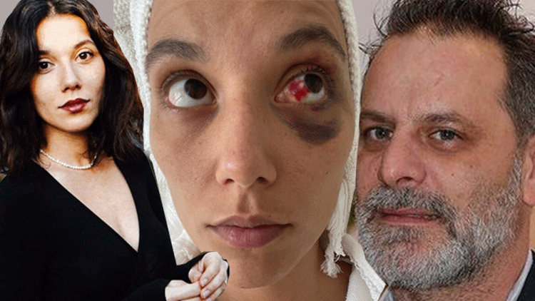 Ozan Güven ve Deniz Bulutsuz’un Darp Davasında Karar Açıklandı Mahkeme