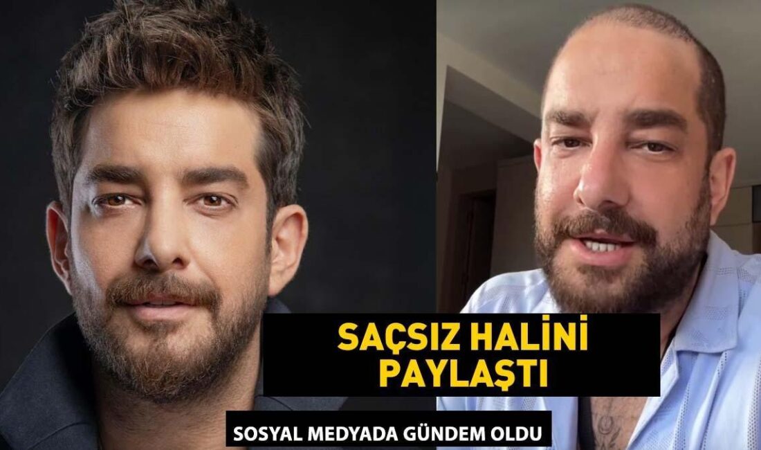 Enis Arıkan, Protez Saç Kullandığını Açıkladı: Son Dakika Gelişmeleri Enis