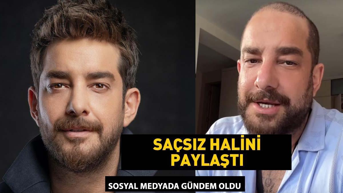 Enis Arikanin Son Dakika Sacsiz Gorunumu Gelisme Yaratti Protez Sac