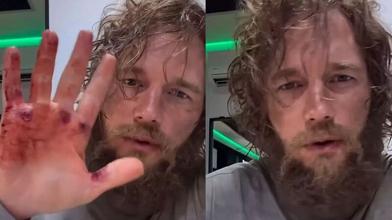 Chris Pratt’in Şaşırtan Yeni Görünümü Sosyal Medyayı SalladıHaberin BaşlıklarıChris Pratt’in