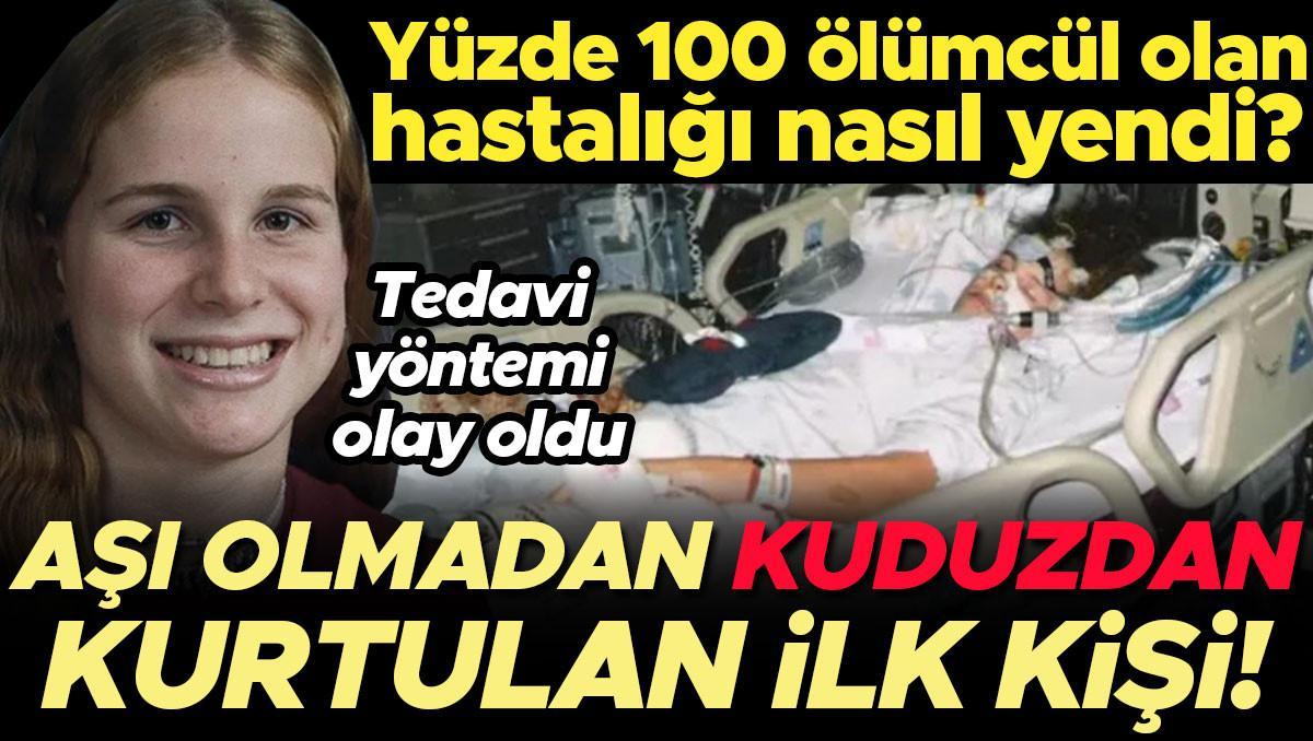 Asisiz Kuduzdan Kurtulan Ilk Kisi Tartismali Yontemle Hayatta Kaldi