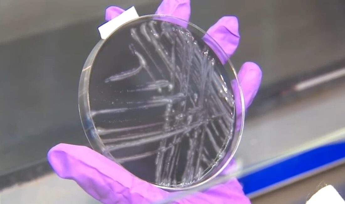 Central Harlem’da Legionnaires Hastalığı Uyarısı New York Şehri Sağlık Departmanı’ndan