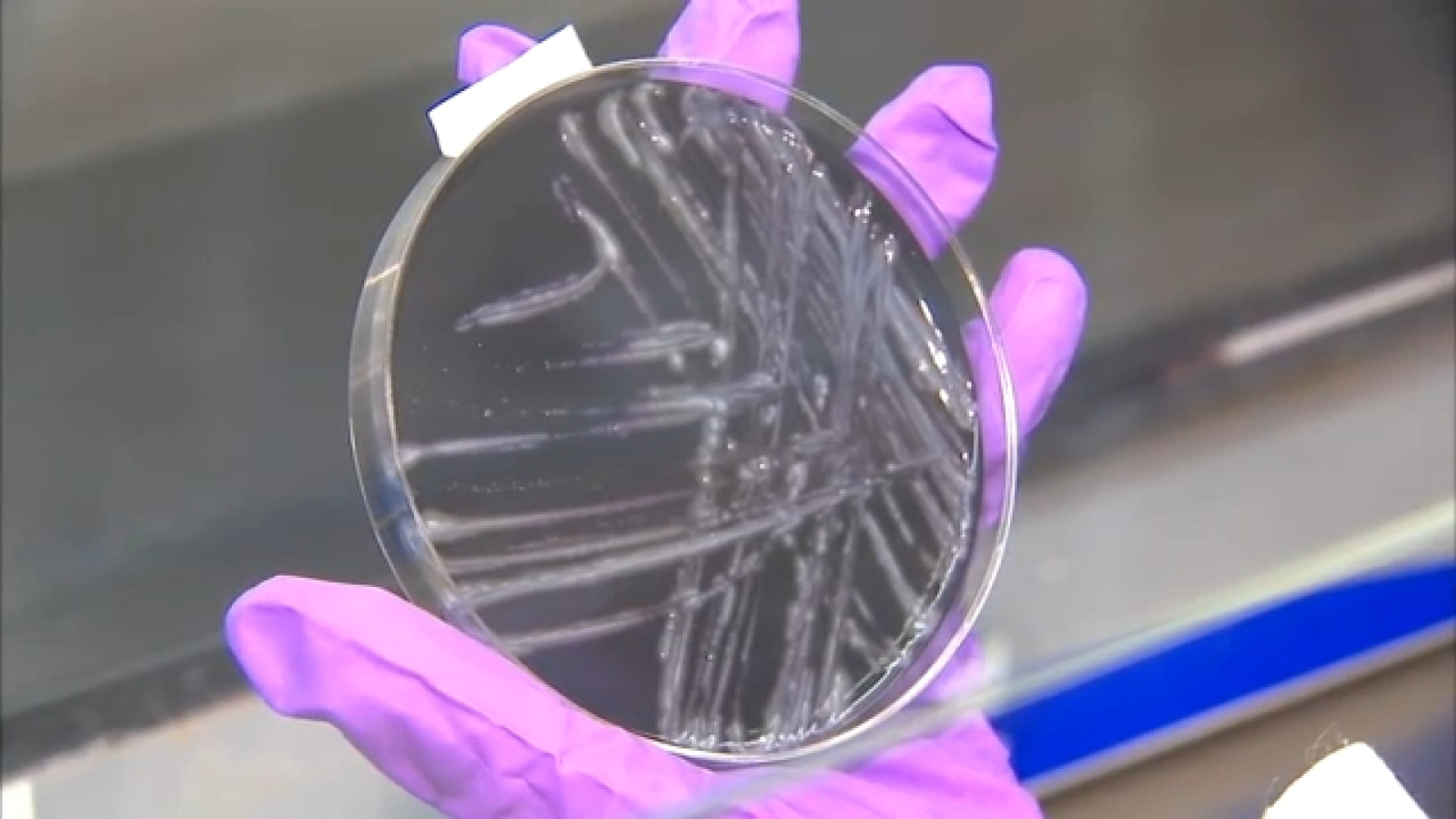 Central Harlem’da Legionnaires Hastalığı Uyarısı New York Şehri Sağlık Departmanı’ndan