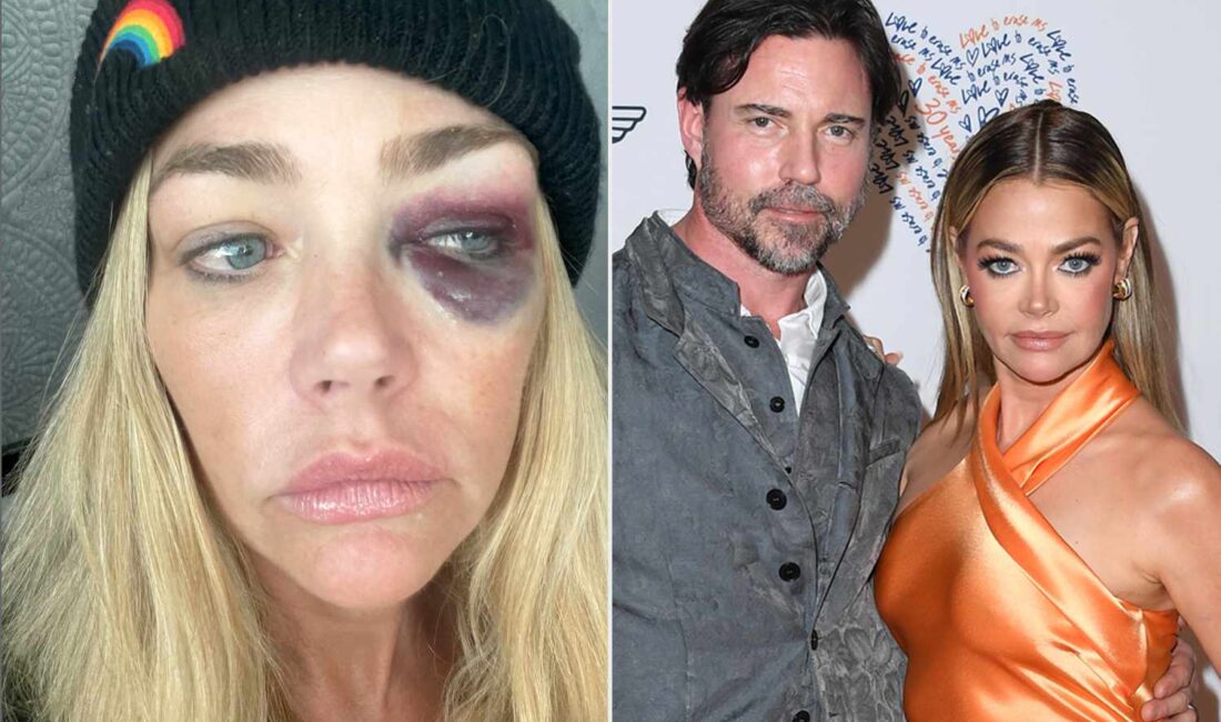 Denise Richards, Aaron Phypers’a Karşı Geçici Tedbir Kararı Aldı: Şiddet