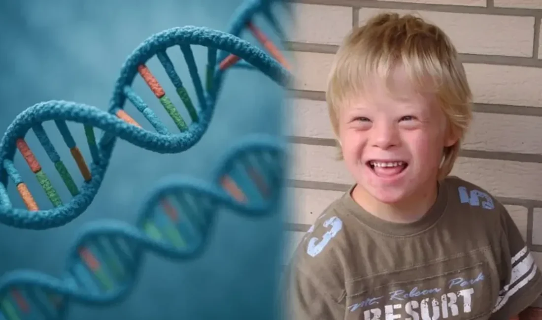 Down Sendromu Tedavisinde Umut Veren Gelişme: CRISPR ile Gen Düzenleme