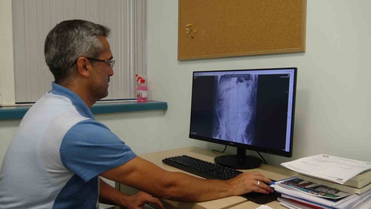 Böbrek Yetmezliği: Erken Teşhis ve Koruyucu Önlemlerin Önemi Böbrek Yetmezliği
