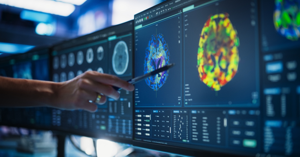 Alzheimer Tedavisinde Lityum Flas Gelismeler ve Saglik Uzerindeki Etkileri