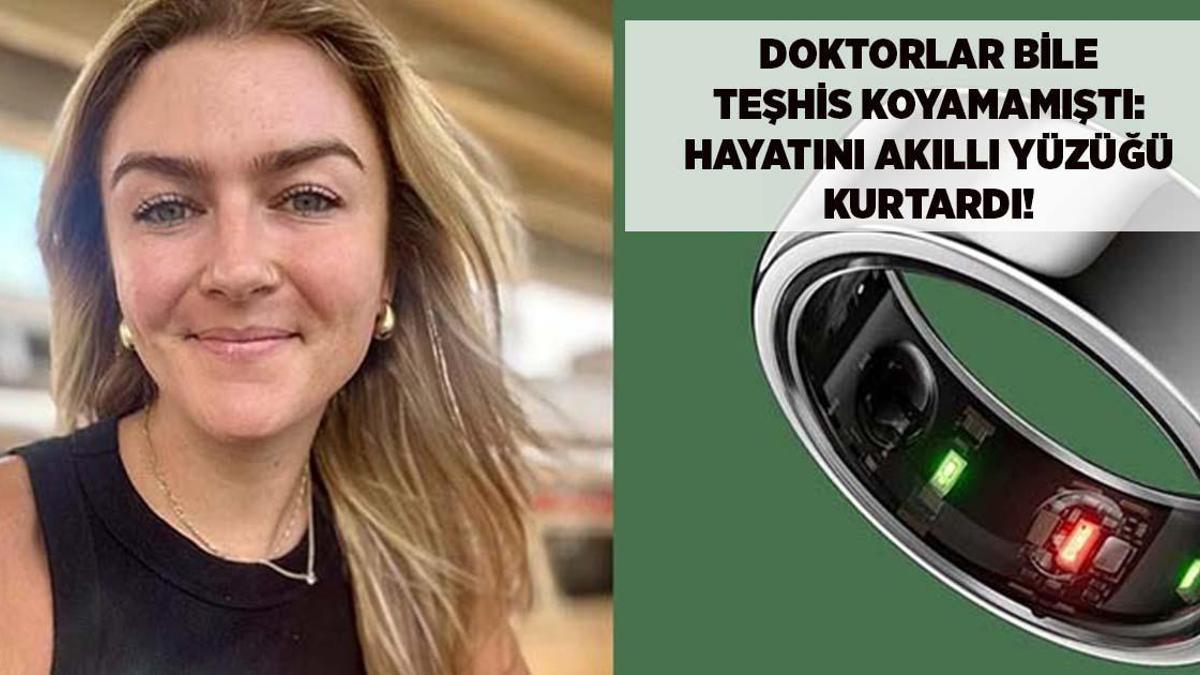 Genc Kadinin Hayatini Akilli Yuzuk Kurtardi Doktorlar Teshis Edemedi