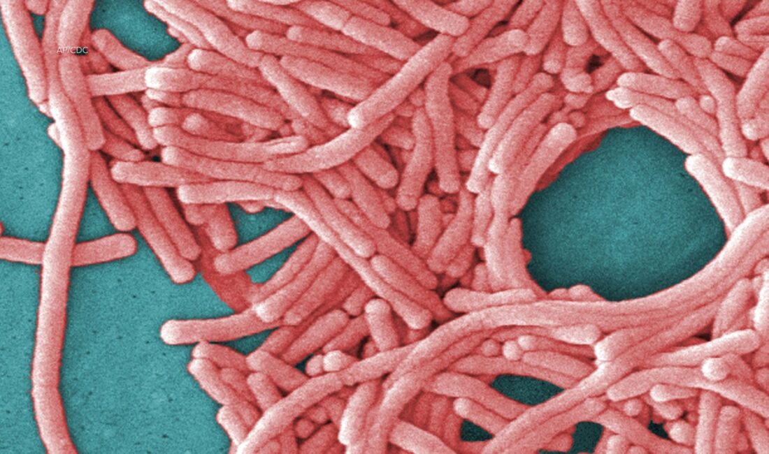 Harlem’de Legionnaires Hastalığı Salgını: İki Kişi Hayatını Kaybetti Legionnaires Hastalığı