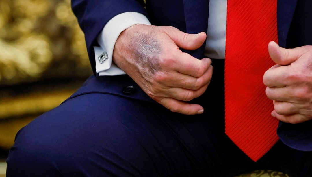 Flaş Gelişme: Trump’ın Sağlık Durumu Hakkında Tartışmalar Yeniden Alevlendi Önemli