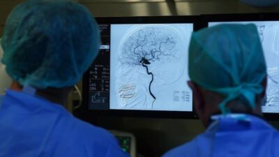 İnme: Acil Müdahale ve Farkındalığın Önemi İnme Nedir ve Neden