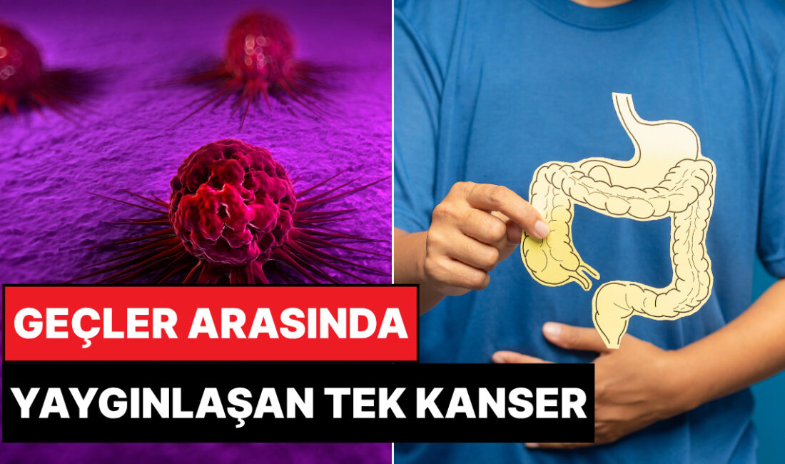 Gençlerde Kolon Kanseri Vakalarında Endişe Verici Artış Kolon Kanseri Neden