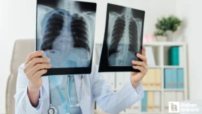 Kadınlarda Akciğer Kanseri Riski: Dr. Serap Ket Alkan’dan Önemli Açıklamalar