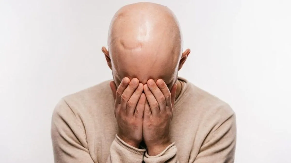 “Acil Flaş Gelişme: Uzmanlar Saç Dökülmesini Hızlandıran Alışkanlığı Açıkladı” Saç Dökülmesi