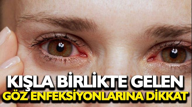 “Bugün Kışla Gelen Göz Enfeksiyonları İçin Acil Sağlık Uyarısı!” Kış Aylarında Göz Enfeksiyonlarına Dikkat: Uzmanlar Uyarıyor Göz Kuruluğu ve