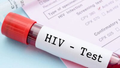 1 Aralık Dünya AIDS Günü: HIV Farkındalığı İçin Erken Tanının