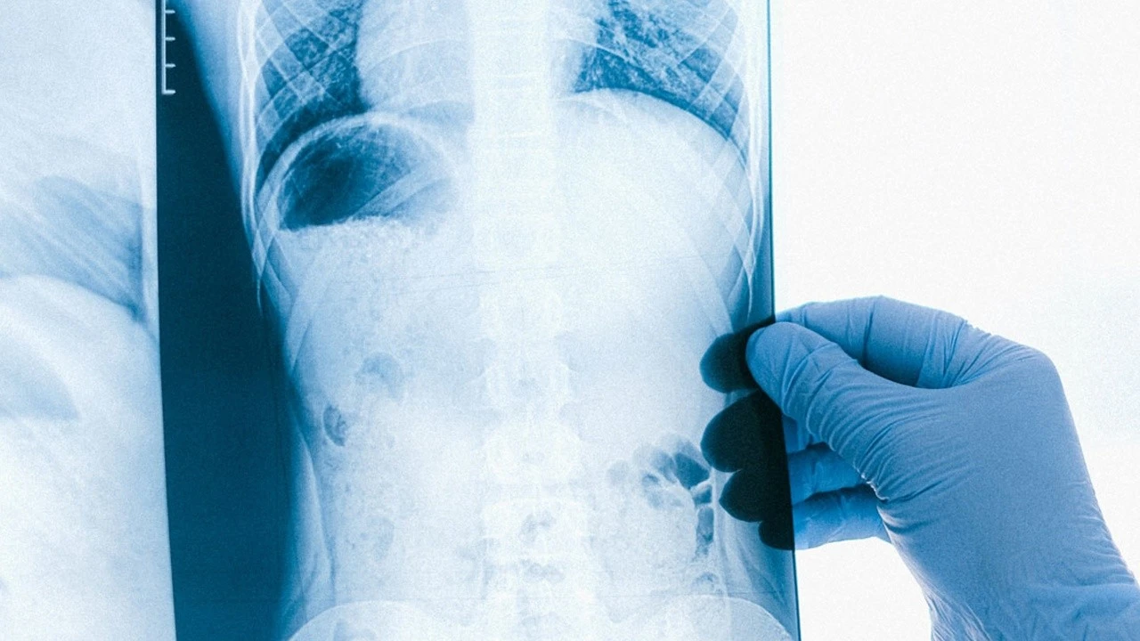 “Kadınlarda Sigara İçilmesi Acil Sağlık Sorunu: Flaş Gelişmeler!” Kadınlarda Akciğer Kanseri