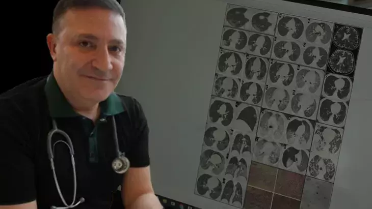 Genç Yaşta Ani Ölüm Vakalarında Artış: Kovid-19’un Gizli Etkileri Mi?