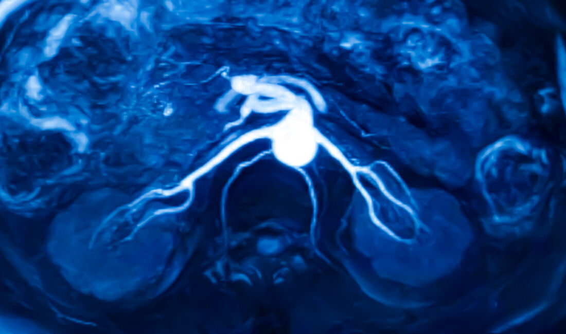 29 Yaşında Kanser Teşhisi: Sağlık Editörü Connor Boyd’un Hikayesi Sağlık