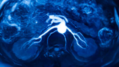 29 Yaşında Kanser Teşhisi: Sağlık Editörü Connor Boyd’un Hikayesi Sağlık